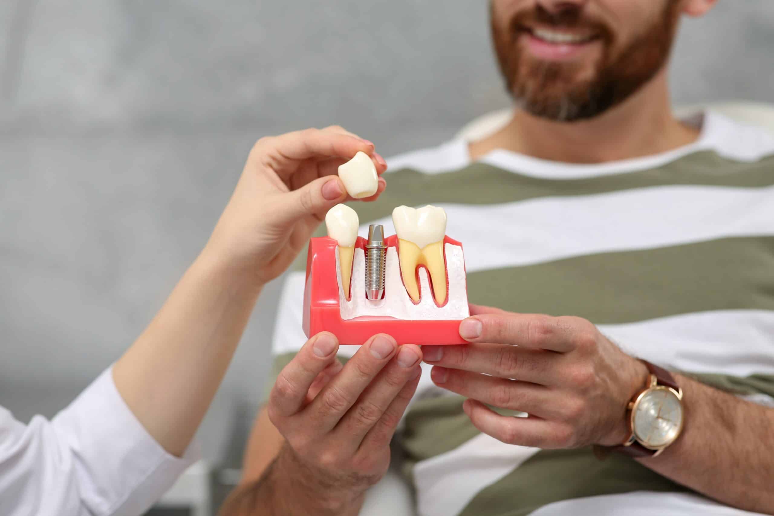 How Do Dental Implants Work?