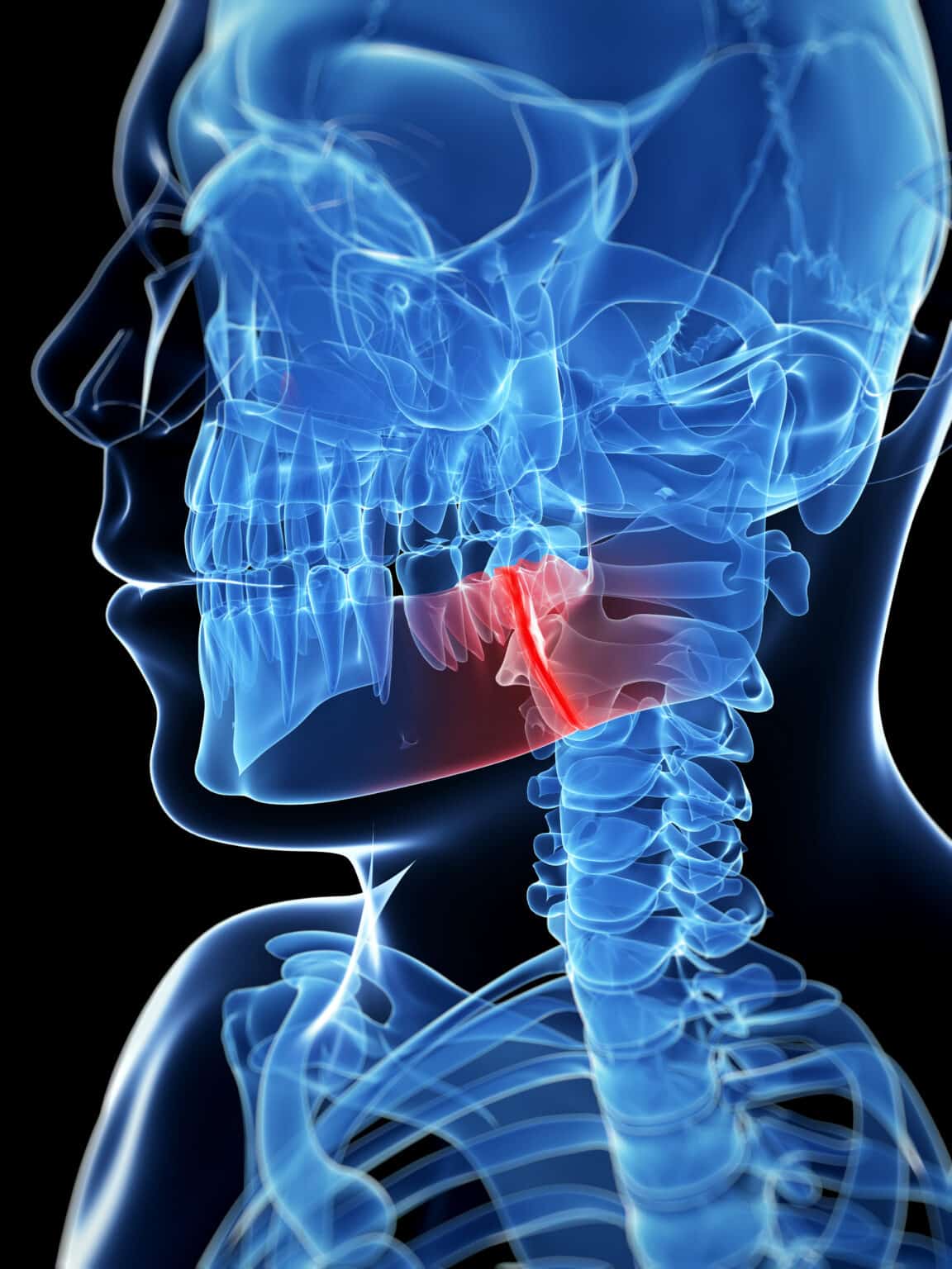 Facial Trauma - Leading Edge Dental