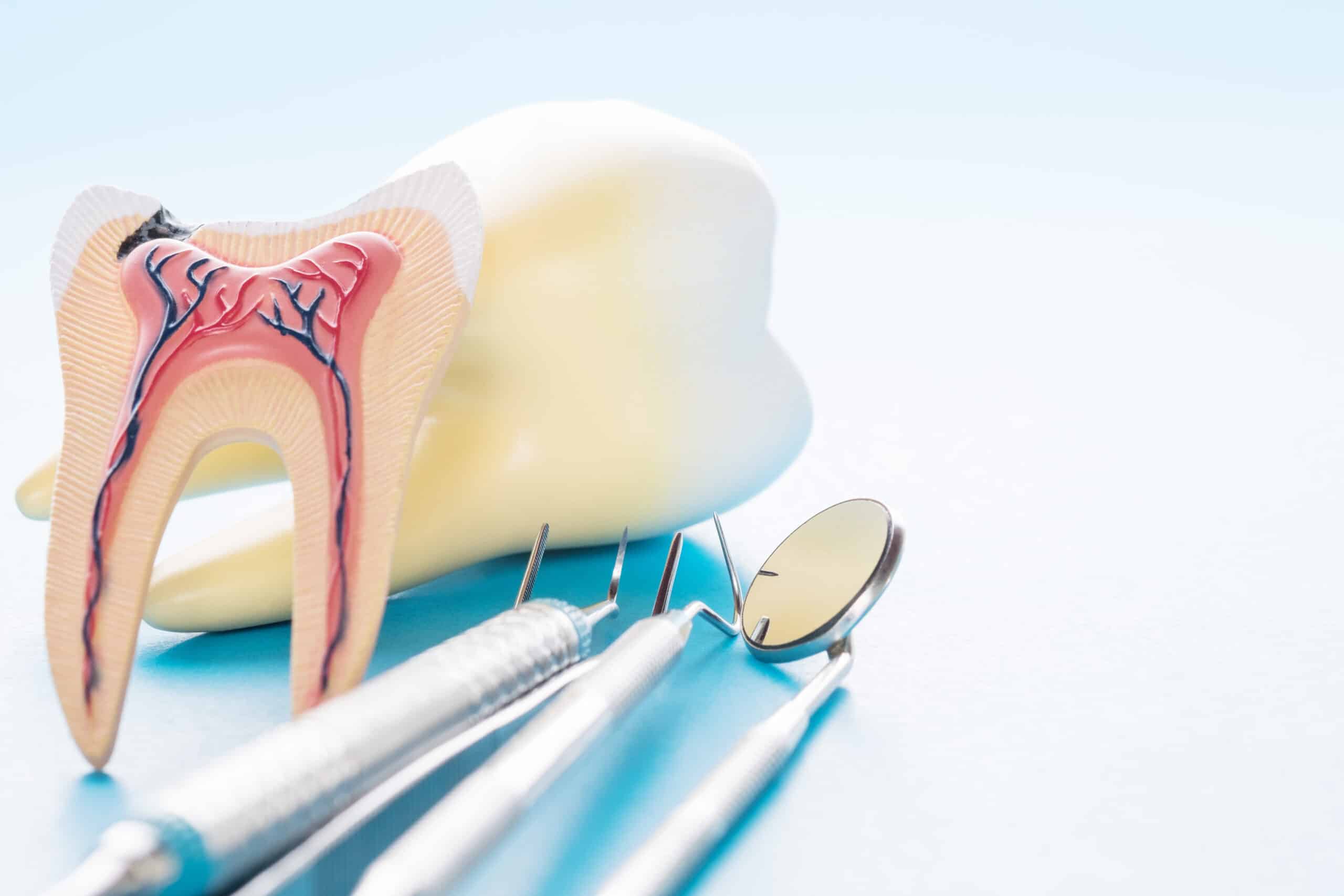 What is Endodontics?