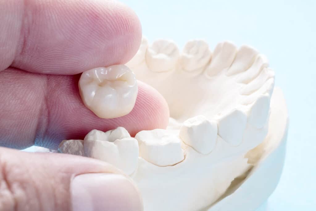 What Does A Prosthodontist Do?
